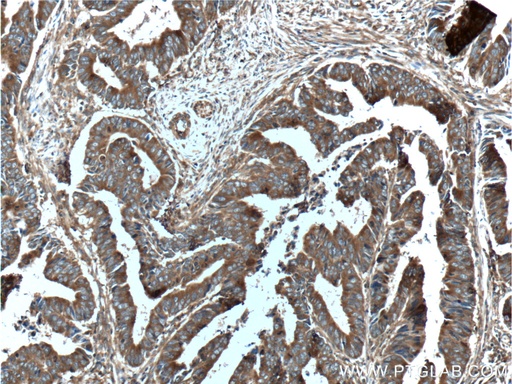 [26581-1-AP-150UL] ST13 Polyclonal antibody