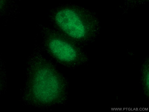 [26583-1-AP-150UL] LIG3 Polyclonal antibody