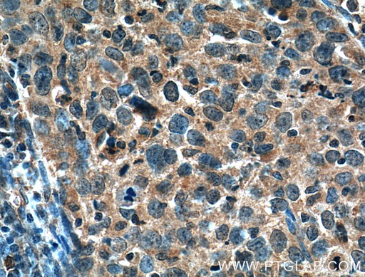 [26585-1-AP-150UL] MMP1 Polyclonal antibody
