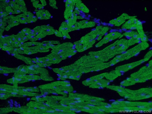 [26592-1-AP-150UL] Cardiac Troponin T Polyclonal antibody