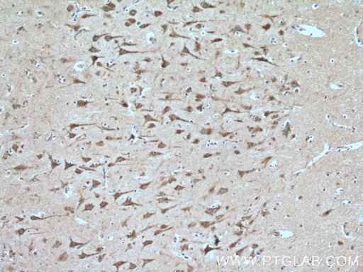 [26594-1-AP-150UL] SIRPD Polyclonal antibody