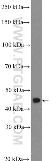 [26595-1-AP-20UL] OTX1 Polyclonal antibody
