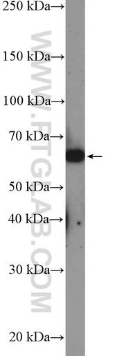 [26608-1-AP-150UL] LOXL1 Polyclonal antibody