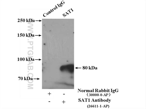 [26611-1-AP-20UL] SAT1 Polyclonal antibody