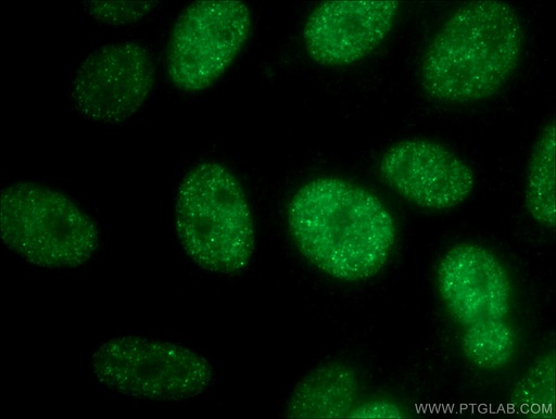 [26613-1-AP-20UL] SMARCA2-Specific Polyclonal antibody