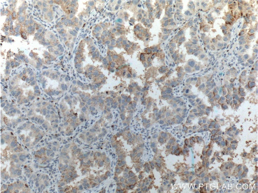 [26620-1-AP-20UL] RHOV Polyclonal antibody