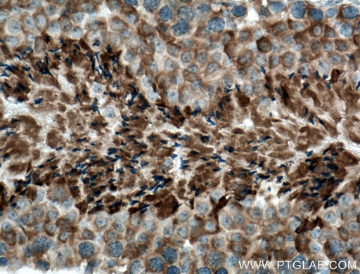 [26630-1-AP-20UL] CLRN1 Polyclonal antibody
