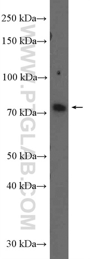 [26633-1-AP-150UL] CATSPERB Polyclonal antibody