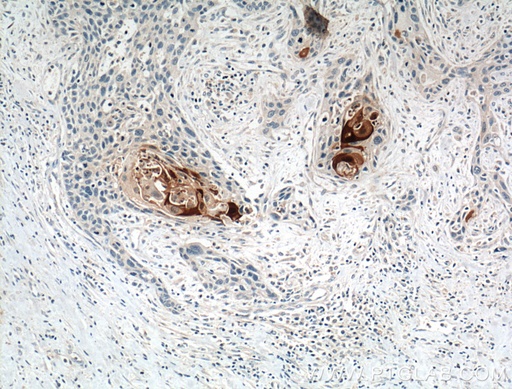 [26656-1-AP-150UL] S100A7/Psoriasin Polyclonal antibody