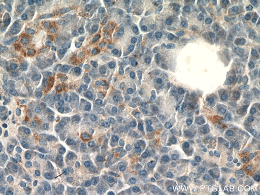 [26663-1-AP-150UL] SLC25A29 Polyclonal antibody