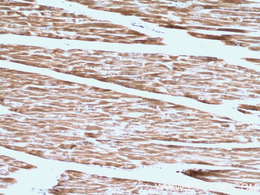[26665-1-AP-150UL] Calsequestrin 1 Polyclonal antibody