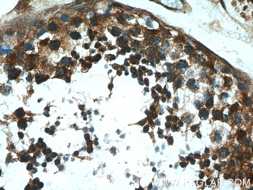 [26666-1-AP-150UL] MAEL Polyclonal antibody