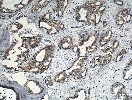 [26677-1-AP-150UL] IL-5 Polyclonal antibody