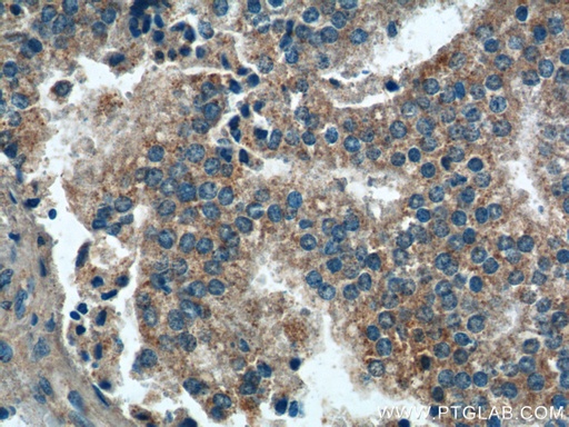 [26679-1-AP-20UL] PARL Polyclonal antibody