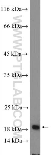 [26685-1-AP-150UL] SSPN Polyclonal antibody