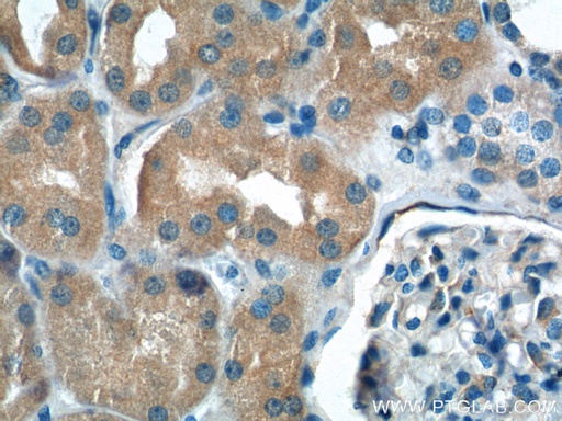 [26706-1-AP-20UL] NPR3 Polyclonal antibody