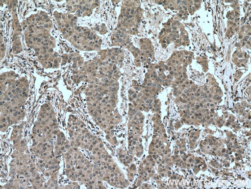 [26718-1-AP-20UL] DUSP9 Polyclonal antibody