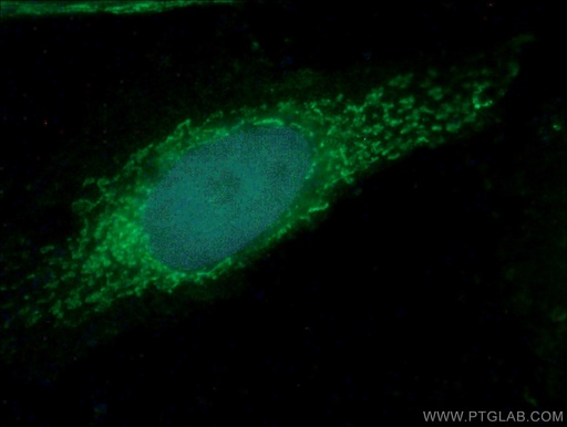 [26723-1-AP-150UL] ATP8 Polyclonal antibody