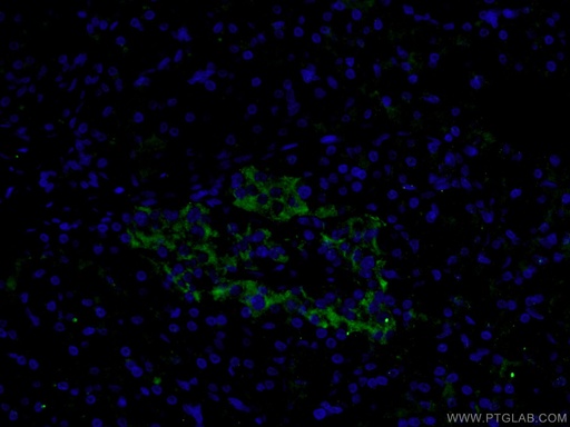 [26731-1-AP-20UL] SLC17A9 Polyclonal antibody