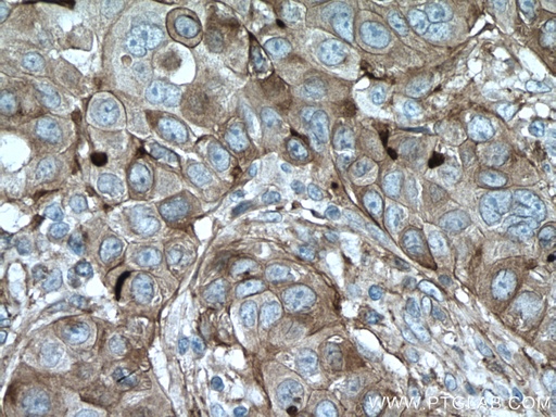[26735-1-AP-20UL] CYBRD1 Polyclonal antibody