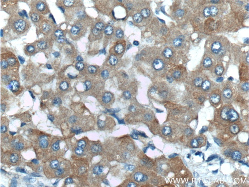 [26746-1-AP-150UL] ENTPD5 Polyclonal antibody