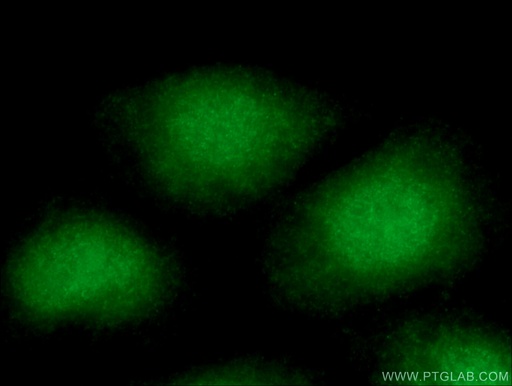 [26747-1-AP-20UL] APTX Polyclonal antibody