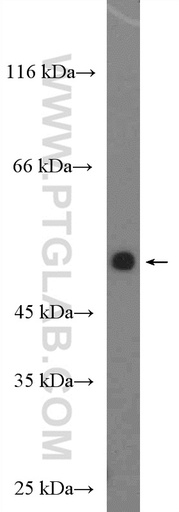 [26750-1-AP-150UL] DIRC2 Polyclonal antibody