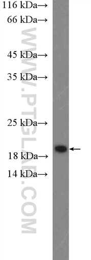 [26754-1-AP-20UL] CENPA Polyclonal antibody