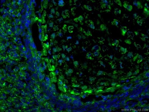 [26757-1-AP-20UL] LIF Polyclonal antibody