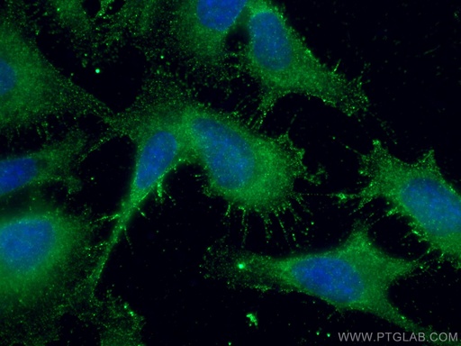 [26759-1-AP-20UL] SUFU Polyclonal antibody