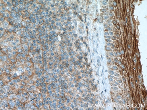 [26767-1-AP-150UL] FCHO1 Polyclonal antibody
