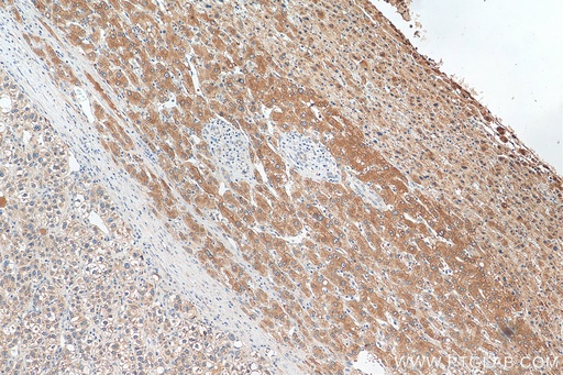 [26768-1-AP-150UL] Plasminogen Polyclonal antibody