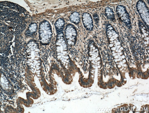 [26772-1-AP-150UL] IL-24 Polyclonal antibody