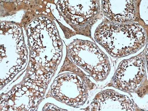 [26782-1-AP-150UL] TMBIM6 Polyclonal antibody