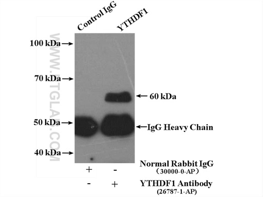 [26787-1-AP-150UL] YTHDF1 Polyclonal antibody