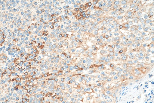 [26788-1-AP-20UL] RASGRF2 Polyclonal antibody
