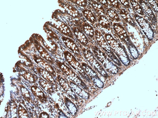 [26789-1-AP-20UL] GRLF1 Polyclonal antibody