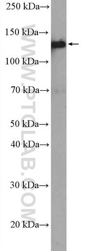 [26795-1-AP-20UL] LAMB3 Polyclonal antibody