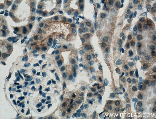 [26796-1-AP-150UL] SLC22A7 Polyclonal antibody