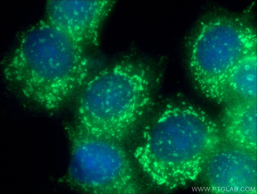 [26798-1-AP-20UL] GPSM2 Polyclonal antibody