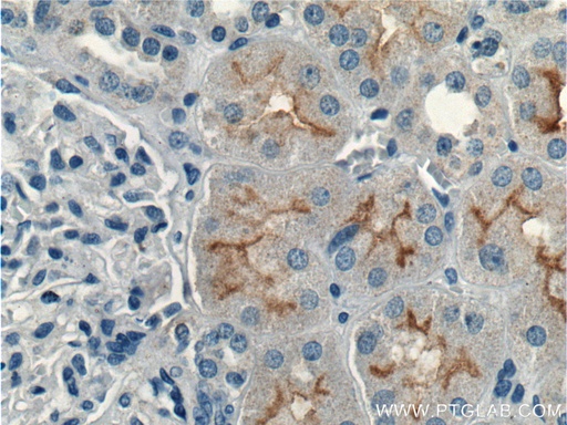 [26812-1-AP-150UL] CLCN5 Polyclonal antibody