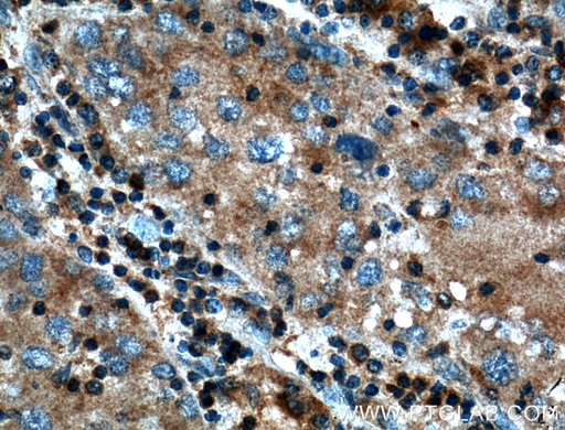 [26815-1-AP-150UL] SAMD8 Polyclonal antibody