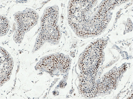 [26818-1-AP-150UL] TP53RK Polyclonal antibody