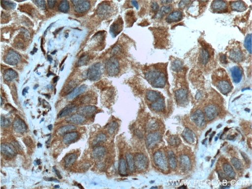 [26824-1-AP-150UL] CPA4 Polyclonal antibody