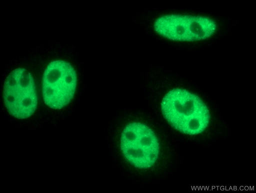 [26825-1-AP-20UL] CstF-64 Polyclonal antibody