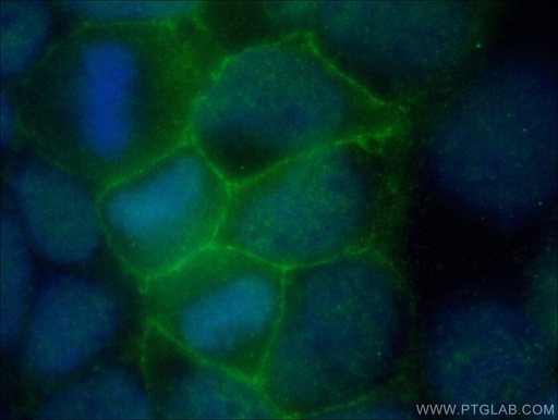 [26841-1-AP-20UL] FLVCR1 Polyclonal antibody