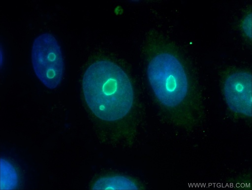 [26854-1-AP-20UL] NOP14 Polyclonal antibody