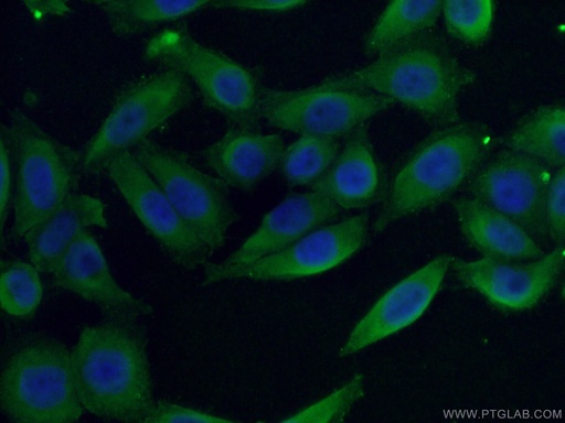 [26855-1-AP-20UL] LTBP1 Polyclonal antibody
