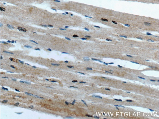 [26868-1-AP-150UL] FAM175B Polyclonal antibody