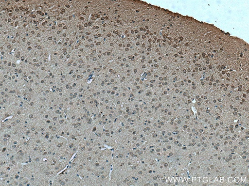 [26869-1-AP-150UL] MYO9A Polyclonal antibody